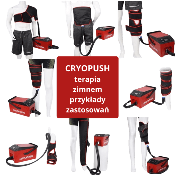Mankiety Cryopush do terapii zimnem z kompresją